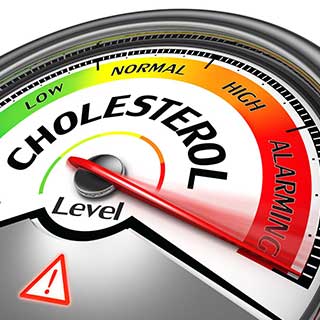 cholesterol320